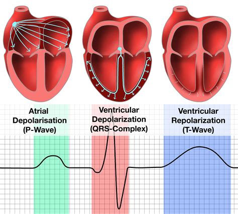 Three hearts showing a P-Wave, QRS-Complex, and a T-Wave Nursing Student Tips, Nursing School ...
