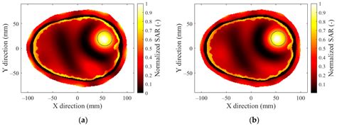 Microwave Hyperthermia of Brain Tumors: A 2D Assessment Parametric ...