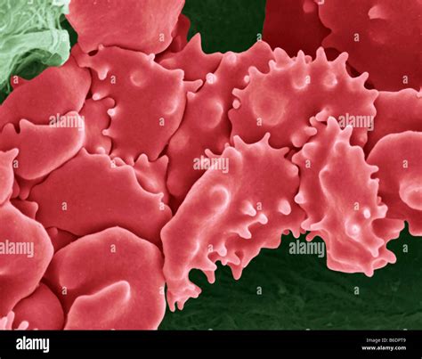Crenated blood clot, coloured scanning electron micrograph (SEM). Red ...