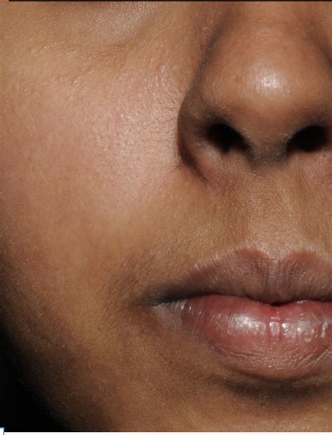 Dark Spot Correcting Serum | Reduce Hyperpigmentation – World of Asaya