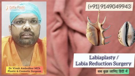 Image result for Labial Reduction Surgery