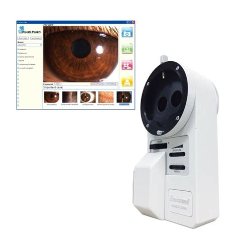 Camera Splitter 的图像结果