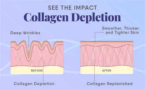 Trunativ Advanced Japanese Marine Collagen Powder |Type 1 and 3 ...