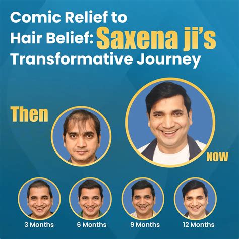 Hair Transplant in Delhi Ncr | Best Hair Transplant Clinic in Delhi, India