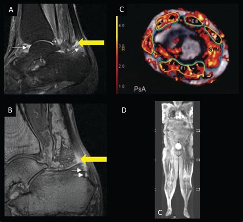 Imaging Techniques: Options for the Diagnosis and Monitoring of ...
