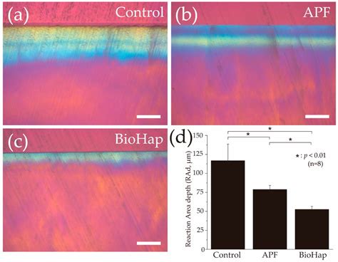 Improved Enamel Acid Resistance Using Biocompatible Nano-Hydroxyapatite ...