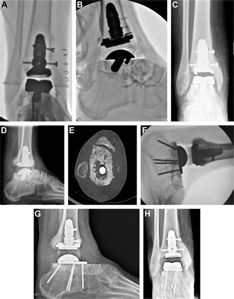 Hardware Monitor Driver 的图像结果