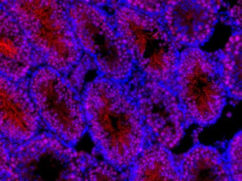 PRM1 antibody (15697-1-AP) | Proteintech