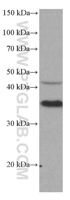 CRK antibody (67035-1-Ig) | Proteintech