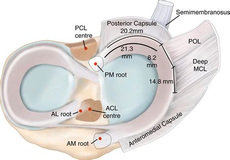 Mcl Vs Meniscus