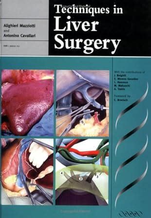Buy Techniques in Liver Surgery Book Online at Low Prices in India ...