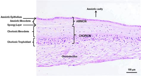 Use of Placental Membranes for the Treatment of Chronic Diabetic Foot ...