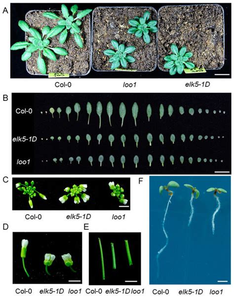 Twin Embryos in Arabidopsis thaliana KATANIN 1 Mutants