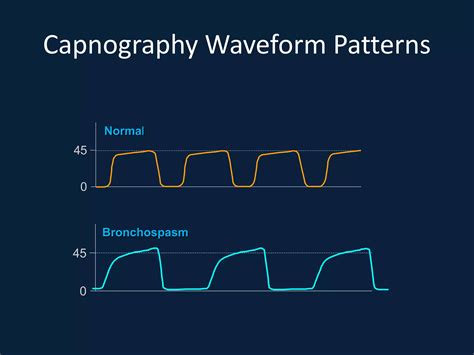 End tidal co2 and transcutaneous monitoring | PPTX