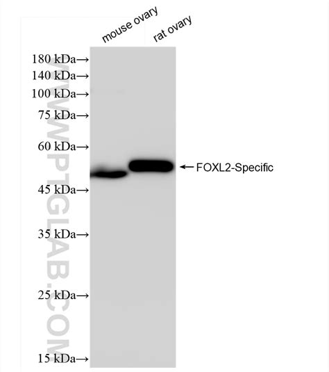 FOXL2-Specific antibody (84144-1-RR) | Proteintech
