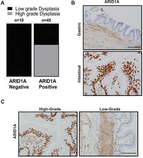 Paradoxical Role of AT-rich Interactive Domain 1A in Restraining ...