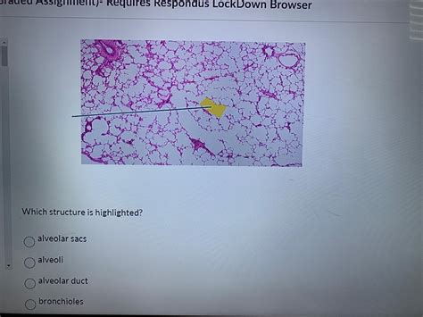 Solved Which structure is highlighted?alveolar | Chegg.com