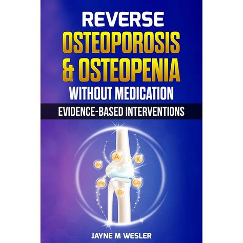 Amazon.com: Reverse Osteoporosis & Osteopenia Without Medication: Evidence-Based Interventions ...