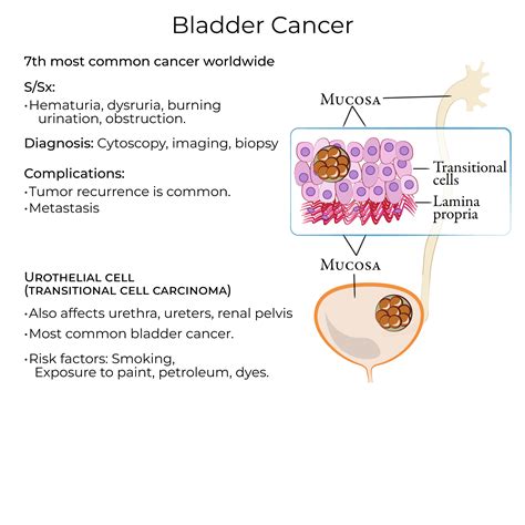 Is Bladder Cancer Hereditary