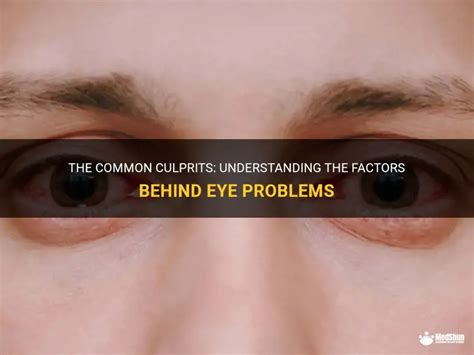 Image result for Solving Eye Problem