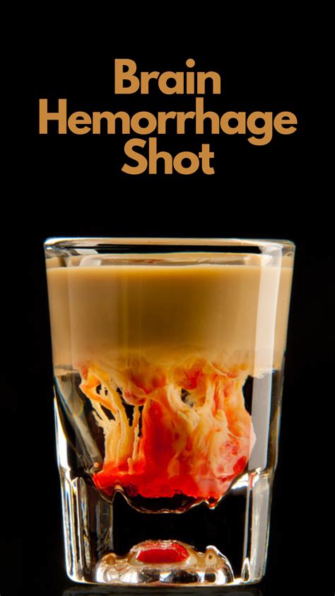 Brain hemorrhage shot – Artofit
