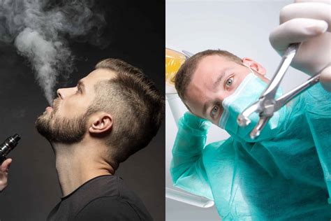 Vaping After Tooth Extraction with Gauze: Guidelines and Risks – Vapes Super Store
