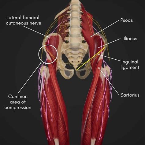 Lateral Femoral Cutaneous Nerve Injection