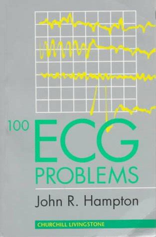 Buy 100 ECG Problems Book Online at Low Prices in India | 100 ECG ...