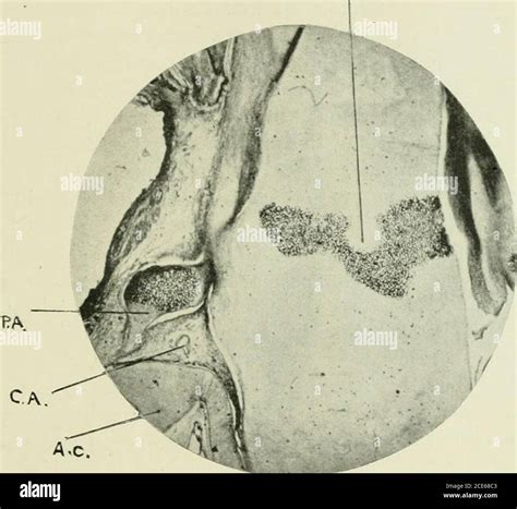 Greater wing sphenoid bone hi-res stock photography and images - Alamy