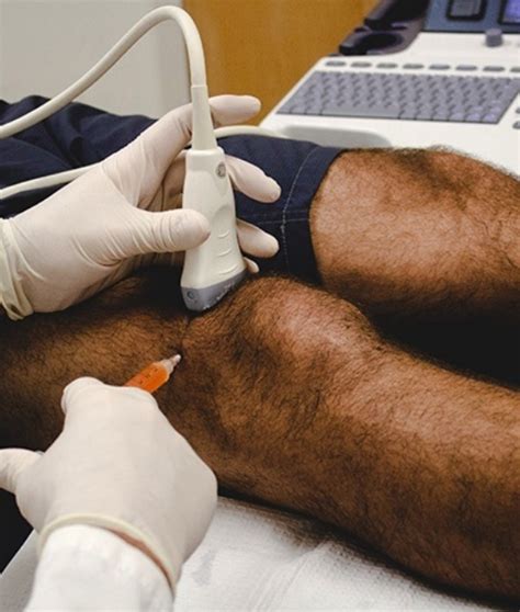 Injection Therapy 的图像结果