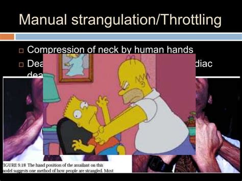 Image result for Strangulation Compression