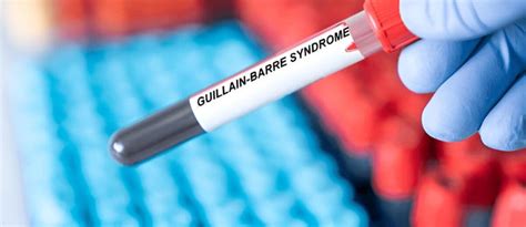 Guillain Barre Syndrome: From Symptoms to Preventions, Everything You ...