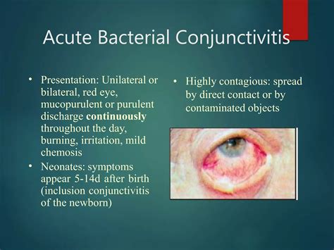 Conjunctivitis 120201025034-phpapp02-converted | PPTX | Infectious Diseases | Diseases and ...
