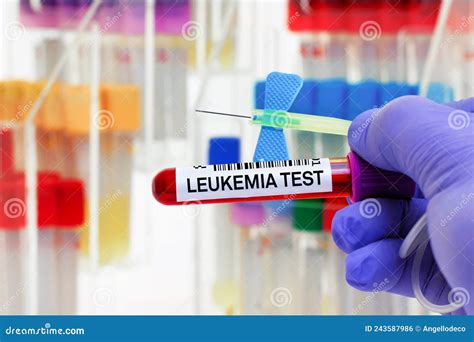 Doctor Holding Blood Tube Sample for Leukemia or Leukaemia Test in Hematology Laboratory Stock ...