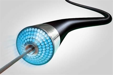 Image result for Laser Lead Extraction Animation Spectranetics