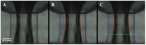 Air-Core–Liquid-Ring (ACLR) Atomization Part II: Influence of Process ...