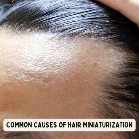 Hair Miniaturization: Causes, Symptoms, and Treatments | Clinikally