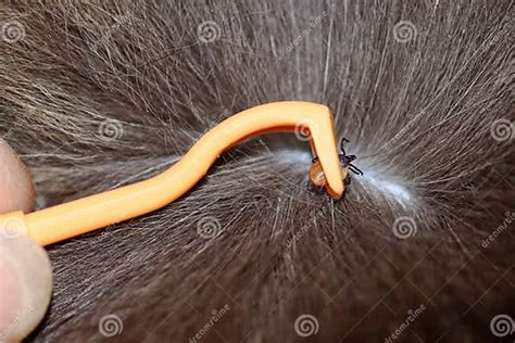 Image result for Insect Removal From Humans