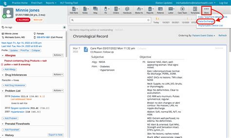 Image result for Ccda Tutorial