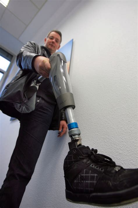 Mit der Beinprothese nach einer Amputation Gehen lernen in Dortmund ...