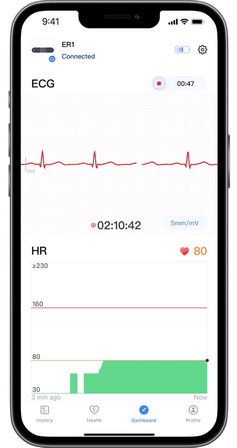 Image result for React Native ECG Graph