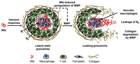 Mathematical Modeling of Tuberculosis Granuloma Activation
