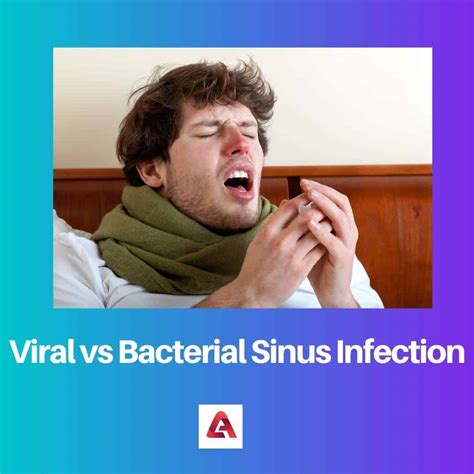 Viral vs Bacterial Sinus Infection: Difference and Comparison