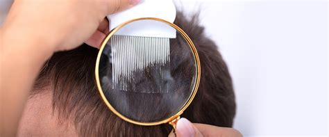 Air Pollution & Hair Loss: Effects & Solutions