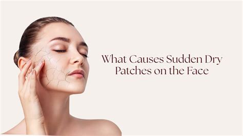 What Causes Sudden Dry Patches on the Face? – Perenne Cosmetics