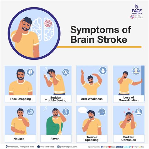 Brain Stroke: Types, Causes, Symptoms, Prevention and Treatment