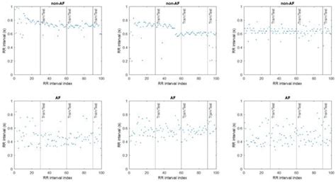 Compressed Deep Learning Models for Wearable Atrial Fibrillation ...