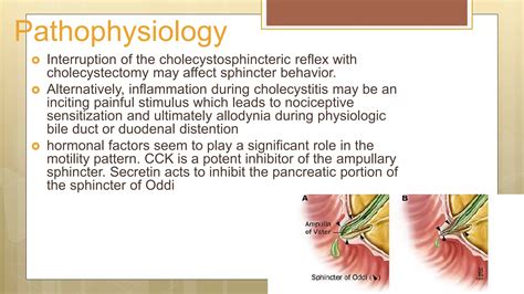 Sods sphincter of Oddi Dysfunction | PPTX