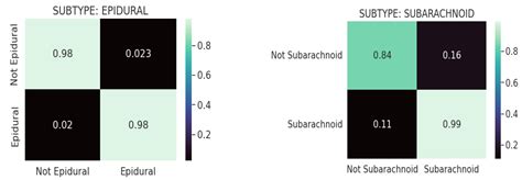 Automated Computer-Aided Detection and Classification of Intracranial ...