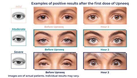 Eye Opening: Định Nghĩa, Cấu Trúc, và Sử Dụng trong Tiếng Anh